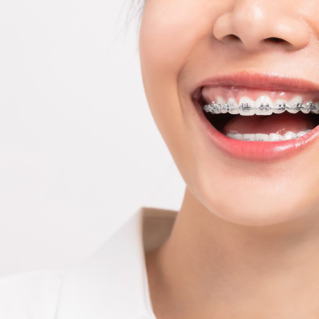 Orthodontic Dentistry